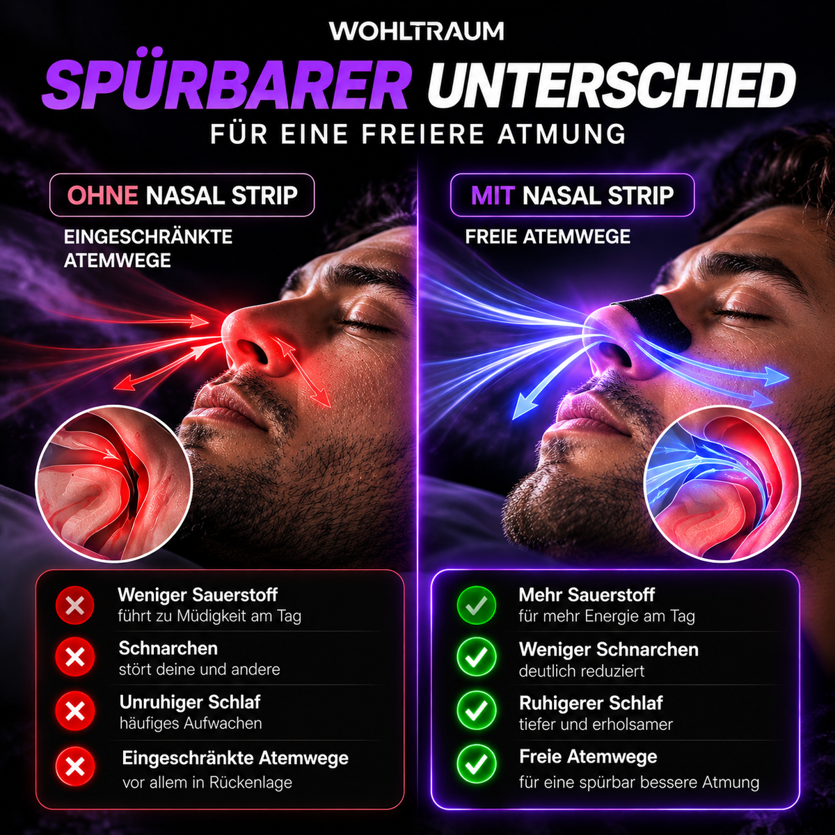 Wohltraum nasal strip